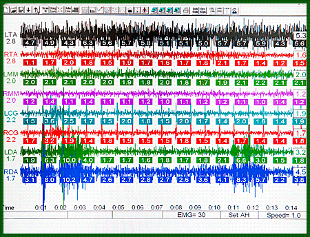 myotronics сонография